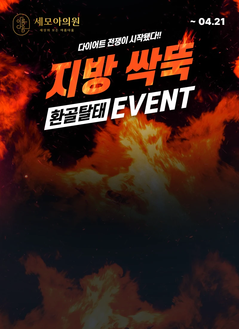 지방 싹뚝 환골탈태 이벤트